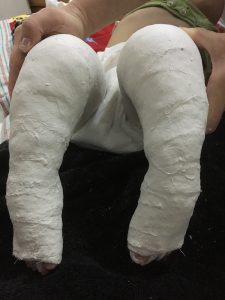 从最开始的不适应到后来带着两条重重的石膏腿翻身,看书,玩积木,在